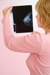doctor looking at mammogram x-ray image